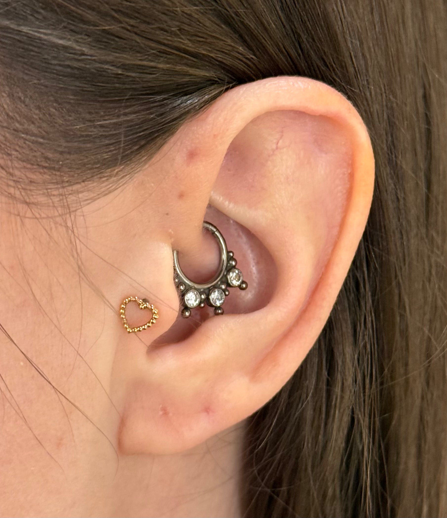 Virtual Ear Curation